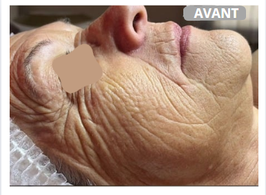 Soins du visage dans votre institut de beauté à Estrées-Saint-Denis (Moyvillers)